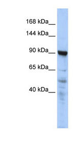 CTAGE5 Antibody - CTAGE5 antibody Western blot of HepG2 cell lysate. This image was taken for the unconjugated form of this product. Other forms have not been tested.