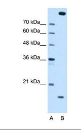 CTAGE5 Antibody - Lane A: Marker. Lane B: HepG2 cell lysate. Antibody concentration: 0.25 ug/ml. Gel concentration: 12%.  This image was taken for the unconjugated form of this product. Other forms have not been tested.