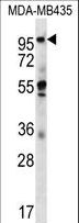 CTAGE5 Antibody - CTAGE5 Antibody western blot of MDA-MB435 cell line lysates (35 ug/lane). The CTAGE5 antibody detected the CTAGE5 protein (arrow).