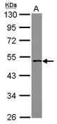 CTB / PCYT1B Antibody - Sample (30 ug of whole cell lysate) A: IMR32 10% SDS PAGE PCYT1B antibody diluted at 1:1000