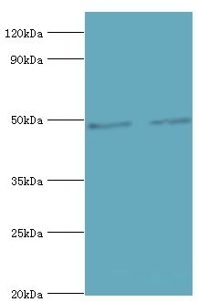 CTBP1 / CTBP Antibody - Western blot. All lanes: C-terminal-binding protein 1 antibody at 6 ug/ml. Lane 1: HeLa whole cell lysate. Lane 2: A549 whole cell lysate. Secondary antibody: Goat polyclonal to rabbit at 1:10000 dilution. Predicted band size: 48 kDa. Observed band size: 48 kDa.