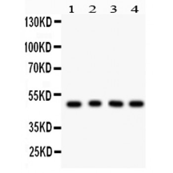 CTBP1 / CTBP Antibody - CTBP1 antibody Western blot. All lanes: Anti CTBP1 at 0.5 ug/ml. Lane 1: Rat Lung Tissue Lysate at 50 ug. Lane 2: Rat Kidney Tissue Lysate at 50 ug. Lane 3: COLO320 Whole Cell Lysate at 40 ug. Lane 4: MCF-7 Whole Cell Lysate at 40 ug. Predicted band size: 48 kD. Observed band size: 48 kD.
