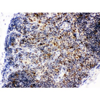 CTBP1 / CTBP Antibody - CTBP1 antibody IHC-paraffin. IHC(P): Mouse Thymus Tissue.