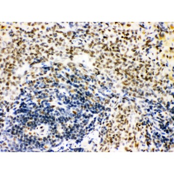 CTBP1 / CTBP Antibody - CTBP1 antibody IHC-paraffin. IHC(P): Rat Spleen Tissue.
