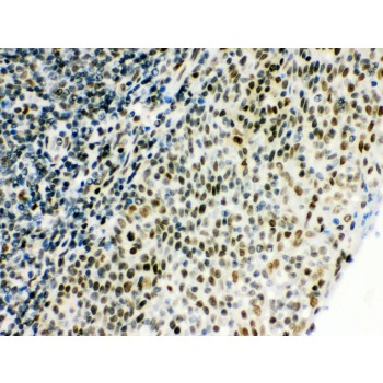 CTBP1 / CTBP Antibody - CTBP1 antibody IHC-paraffin. IHC(P): Human Tonsil Tissue.