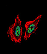 CTBP1 / CTBP Antibody - Fluorescent confocal image of HeLa cell stained with CTBP1 Antibody. HeLa cells were fixed with 4% PFA (20 min), permeabilized with Triton X-100 (0.1%, 10 min), then incubated with CTBP1 primary antibody (1:25, 1 h at 37°C). For secondary antibody, Alexa Fluor 488 conjugated donkey anti-rabbit antibody (green) was used (1:400, 50 min at 37°C). Cytoplasmic actin was counterstained with Alexa Fluor 555 (red) conjugated Phalloidin (7units/ml, 1 h at 37°C). Nuclei were counterstained with DAPI (blue) (10 ug/ml, 10 min). CTBP1 immunoreactivity is localized to nucleus significantly.