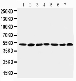 CTBP1 / CTBP Antibody - WB of CTBP1 / CTBP antibody. All lanes: Anti-CTBP1 at 0.5ug/ml. Lane 1: Rat Brain Tissue Lysate at 40ug. Lane 2: Rat Testis Tissue Lysate at 40ug. Lane 3: Rat Ovary Tissue Lysate at 40ug. Lane 4: U87 Whole Cell Lysate at 40ug. Lane 5: SW620 Whole Cell Lysate at 40ug. Lane 6: HT1080 Whole Cell Lysate at 40ug. Lane 7: COLO320 Whole Cell Lysate at 40ug. Predicted bind size: 47KD. Observed bind size: 47KD.