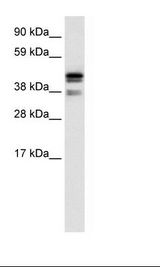 CTBP1 / CTBP Antibody - Fetal Thymus Lysate.  This image was taken for the unconjugated form of this product. Other forms have not been tested.