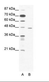 CTBP1 / CTBP Antibody - A: Marker, B: Jurkat Cell Lysate.  This image was taken for the unconjugated form of this product. Other forms have not been tested.