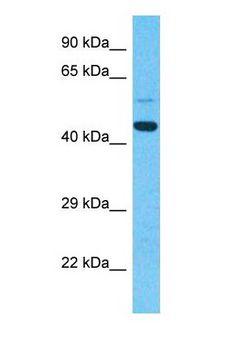 CTBP1 / CTBP Antibody - Western blot of CtBP1 Antibody with human Fetal Lung lysate.  This image was taken for the unconjugated form of this product. Other forms have not been tested.