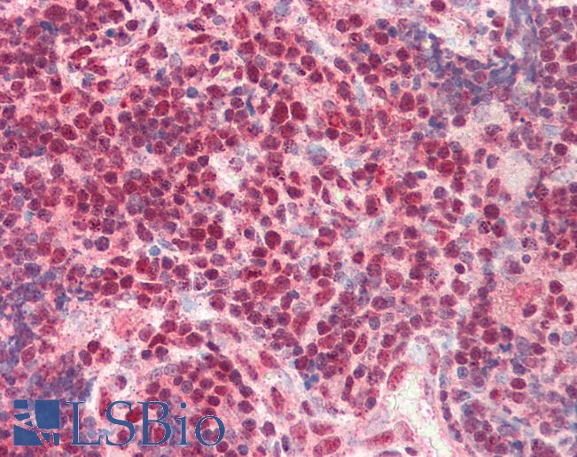 CTBP1 / CTBP Antibody - Human, Thymus: Formalin-Fixed Paraffin-Embedded (FFPE).  This image was taken for the unconjugated form of this product. Other forms have not been tested.