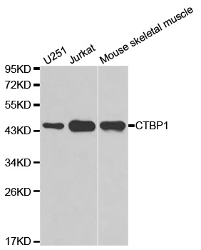 CTBP1 / CTBP Antibody - Western blot analysis of extracts of various cell lines.