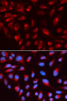 CTBP1 / CTBP Antibody - Immunofluorescence analysis of U2OS cells.