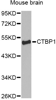 CTBP1 / CTBP Antibody - Western blot analysis of extracts of mouse brain, using CTBP1 antibody at 1:1000 dilution. The secondary antibody used was an HRP Goat Anti-Rabbit IgG (H+L) at 1:10000 dilution. Lysates were loaded 25ug per lane and 3% nonfat dry milk in TBST was used for blocking. An ECL Kit was used for detection.