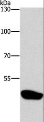 CTBP1 / CTBP Antibody - Western blot analysis of Mouse brain tissue, using CTBP1 Polyclonal Antibody at dilution of 1:500.