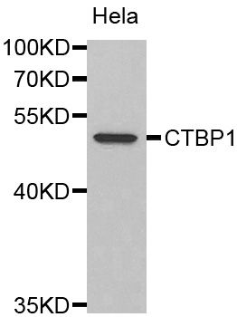 CTBP1 / CTBP Antibody - Western blot analysis of extracts of HeLa cells, using CTBP1 antibody. The secondary antibody used was an HRP Goat Anti-Rabbit IgG (H+L) at 1:10000 dilution. Lysates were loaded 25ug per lane and 3% nonfat dry milk in TBST was used for blocking.