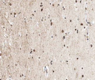 CTBP1 / CTBP Antibody - 1:100 staining human brain tissue by IHC-P. The tissue was formaldehyde fixed and a heat mediated antigen retrieval step in citrate buffer was performed. The tissue was then blocked and incubated with the antibody for 1.5 hours at 22°C. An HRP conjugated goat anti-rabbit antibody was used as the secondary.