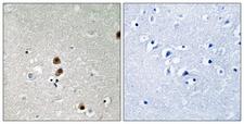 CTBP1 / CTBP Antibody - Immunohistochemistry analysis of paraffin-embedded human brain, using CtBP1 (Phospho-Ser422) Antibody. The picture on the right is blocked with the phospho peptide.