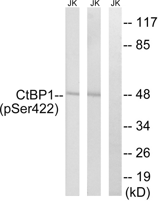 CTBP1 / CTBP Antibody - Western blot analysis of lysates from Jurkat cells treated with TNF 20ng/ml 30' and Jurkat cells treated with UV 15', using CtBP1 (Phospho-Ser422) Antibody. The lane on the right is blocked with the phospho peptide.