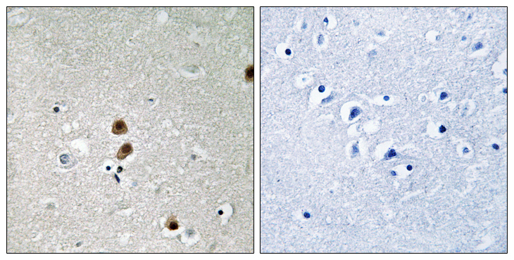 CTBP1 / CTBP Antibody - Immunohistochemistry of paraffin-embedded human brain tissue, using CtBP1 (Phospho-Ser422) antibody.