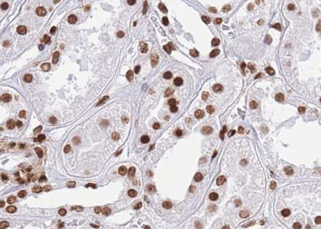CTBP1 / CTBP Antibody - 1:100 staining human kidney tissue by IHC-P. The tissue was formaldehyde fixed and a heat mediated antigen retrieval step in citrate buffer was performed. The tissue was then blocked and incubated with the antibody for 1.5 hours at 22°C. An HRP conjugated goat anti-rabbit antibody was used as the secondary.