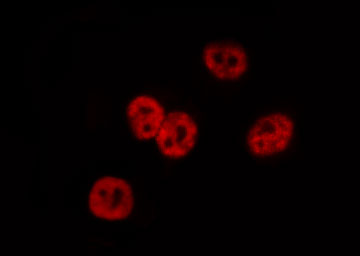 CTBP1 / CTBP Antibody - Staining HeLa cells by IF/ICC. The samples were fixed with PFA and permeabilized in 0.1% Triton X-100, then blocked in 10% serum for 45 min at 25°C. The primary antibody was diluted at 1:200 and incubated with the sample for 1 hour at 37°C. An Alexa Fluor 594 conjugated goat anti-rabbit IgG (H+L) Ab, diluted at 1/600, was used as the secondary antibody.