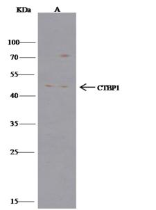 CTBP1 / CTBP Antibody - CTBP1 was immunoprecipitated using: Lane A: 0.5 mg Hela Whole Cell Lysate. 1 uL anti-CTBP1 rabbit polyclonal antibody and 15 ul of 50% Protein G agarose. Primary antibody: Anti-CTBP1 rabbit polyclonal antibody, at 1:500 dilution. Secondary antibody: Clean-Blot IP Detection Reagent (HRP) at 1:500 dilution. Developed using the DAB staining technique. Performed under reducing conditions. Predicted band size: 48 kDa. Observed band size: 48 kDa.
