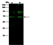 CTBP1 / CTBP Antibody - Anti-CTBP1 rabbit polyclonal antibody at 1:500 dilution. Lane A: Jurkat Whole Cell Lysate. Lane B: HeLa Whole Cell Lysate. Lysates/proteins at 30 ug per lane. Secondary: Goat Anti-Rabbit IgG H&L (Dylight 800) at 1/10000 dilution. Developed using the Odyssey technique. Performed under reducing conditions. Predicted band size: 49 kDa. Observed band size: 49 kDa. (We are unsure as to the identity of these extra bands.)