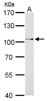 CTBP2 Antibody - CtBP2 antibody detects CTBP2 protein by Western blot analysis. A. 30 ug A375 whole cell lysate/extract. 7.5 % SDS-PAGE. CtBP2 antibody dilution:1:500