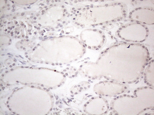 CTBP2 Antibody - Immunohistochemical staining of paraffin-embedded Human thyroid tissue within the normal limits using anti-CTBP2 mouse monoclonal antibody. (Heat-induced epitope retrieval by 1mM EDTA in 10mM Tris buffer. (pH8.5) at 120°C for 3 min. (1:150)
