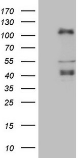 CTBP2 Antibody - HEK293T cells were transfected with the pCMV6-ENTRY control. (Left lane) or pCMV6-ENTRY CTBP2. (Right lane) cDNA for 48 hrs and lysed. Equivalent amounts of cell lysates. (5 ug per lane) were separated by SDS-PAGE and immunoblotted with anti-CTBP2. (1:2000)
