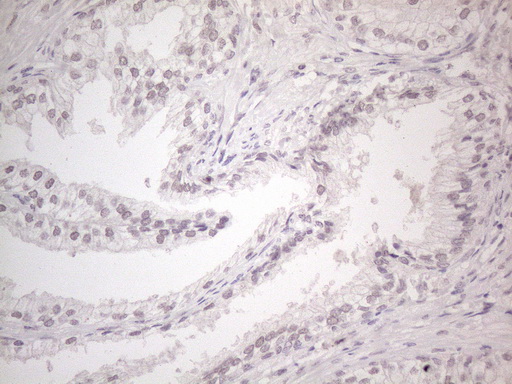 CTBP2 Antibody - Immunohistochemical staining of paraffin-embedded Human prostate tissue within the normal limits using anti-CTBP2 mouse monoclonal antibody. (Heat-induced epitope retrieval by 1mM EDTA in 10mM Tris buffer. (pH8.5) at 120°C for 3 min. (1:150)