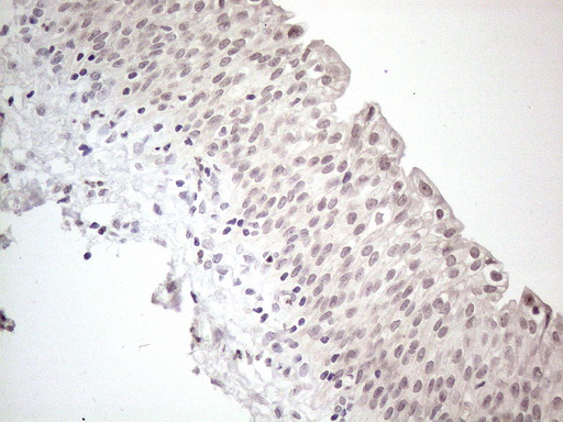 CTBP2 Antibody - Immunohistochemical staining of paraffin-embedded Human bladder tissue within the normal limits using anti-CTBP2 mouse monoclonal antibody. (Heat-induced epitope retrieval by 1mM EDTA in 10mM Tris buffer. (pH8.5) at 120°C for 3 min. (1:150)
