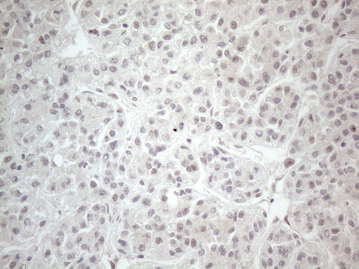 CTBP2 Antibody - Immunohistochemical staining of paraffin-embedded Human liver tissue within the normal limits using anti-CTBP2 mouse monoclonal antibody. (Heat-induced epitope retrieval by 1mM EDTA in 10mM Tris buffer. (pH8.5) at 120°C for 3 min. (1:150)