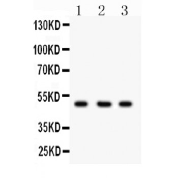 CTBP2 Antibody - CTBP2 antibody Western blot. All lanes: Anti CTBP2 at 0.5 ug/ml. Lane 1: COLO320 Whole Cell Lysate at 40 ug. Lane 2: 293T Whole Cell Lysate at 40 ug. Lane 3: HELA Whole Cell Lysate at 40 ug. Predicted band size: 49 kD. Observed band size: 49 kD.