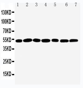CTBP2 Antibody - WB of CTBP2 antibody. All lanes: Anti-CTBP2 at 0.5ug/ml. Lane 1: Rat Brain Tissue Lysate at 40ug. Lane 2: Rat Spleen Tissue Lysate at 40ug. Lane 3: HELA Whole Cell Lysate at 40ug. Lane 4: 293T Whole Cell Lysate at 40ug. Lane 5: COLO320 Whole Cell Lysate at 40ug. Lane 6: U87 Whole Cell Lysate at 40ug. Lane 7: SW620 Whole Cell Lysate at 40ug. Predicted bind size: 49KD. Observed bind size: 49KD.