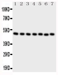 CTBP2 Antibody - Western blot analysis of CTBP2 using anti-CTBP2 antibody. Electrophoresis was performed on a 5-20% SDS-PAGE gel at 70V (Stacking gel) / 90V (Resolving gel) for 2-3 hours. The sample well of each lane was loaded with 50ug of sample under reducing conditions. Lane 1: rat brain tissue lysates, Lane 2: rat spleen tissue lysates, Lane 3: HELA whole cell lysates, Lane 4: 293T whole cell lysates. Lane 5: Colo-320 whole cell lysates, Lane 6: U87 whole cell lysates, Lane 7: SW620 whole cell lysates, After Electrophoresis, proteins were transferred to a Nitrocellulose membrane at 150mA for 50-90 minutes. Blocked the membrane with 5% Non-fat Milk/ TBS for 1.5 hour at RT. The membrane was incubated with rabbit anti-CTBP2 antigen affinity purified polyclonal antibody at 0.5 µg/mL overnight at 4°C, then washed with TBS-0.1% Tween 3 times with 5 minutes each and probed with a goat anti-rabbit IgG-HRP secondary antibody at a dilution of 1:10000 for 1.5 hour at RT. The signal is developed using an Enhanced Chemiluminescent detection (ECL) kit with Tanon 5200 system. A specific band was detected for CTBP2 at approximately 49KD. The expected band size for CTBP2 is at 49KD.