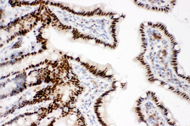 CTBP2 Antibody - IHC analysis of CTBP2 using anti-CTBP2 antibody. CTBP2 was detected in paraffin-embedded section of rat intestine tissues. Heat mediated antigen retrieval was performed in citrate buffer (pH6, epitope retrieval solution) for 20 mins. The tissue section was blocked with 10% goat serum. The tissue section was then incubated with 1µg/ml rabbit anti-CTBP2 Antibody overnight at 4°C. Biotinylated goat anti-rabbit IgG was used as secondary antibody and incubated for 30 minutes at 37°C. The tissue section was developed using Strepavidin-Biotin-Complex (SABC) with DAB as the chromogen.