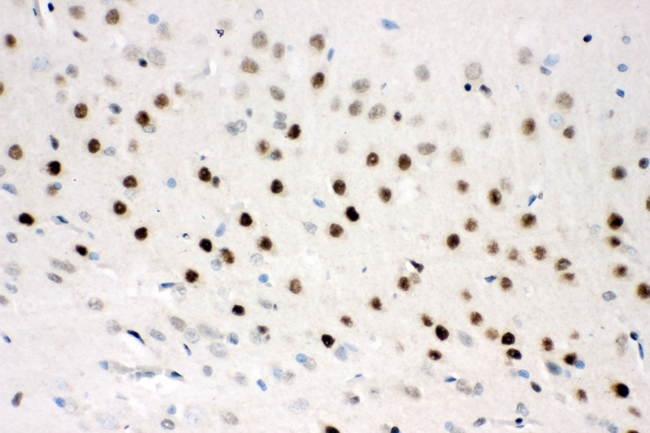 CTBP2 Antibody - IHC analysis of CTBP2 using anti-CTBP2 antibody. CTBP2 was detected in paraffin-embedded section of rat brain tissues. Heat mediated antigen retrieval was performed in citrate buffer (pH6, epitope retrieval solution) for 20 mins. The tissue section was blocked with 10% goat serum. The tissue section was then incubated with 1µg/ml rabbit anti-CTBP2 Antibody overnight at 4°C. Biotinylated goat anti-rabbit IgG was used as secondary antibody and incubated for 30 minutes at 37°C. The tissue section was developed using Strepavidin-Biotin-Complex (SABC) with DAB as the chromogen.