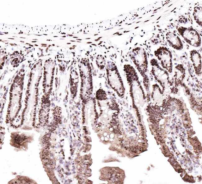 CTBP2 Antibody - IHC analysis of CTBP2 using anti-CTBP2 antibody. CTBP2 was detected in paraffin-embedded section of mouse intestine tissues. Heat mediated antigen retrieval was performed in citrate buffer (pH6, epitope retrieval solution) for 20 mins. The tissue section was blocked with 10% goat serum. The tissue section was then incubated with 1µg/ml rabbit anti-CTBP2 Antibody overnight at 4°C. Biotinylated goat anti-rabbit IgG was used as secondary antibody and incubated for 30 minutes at 37°C. The tissue section was developed using Strepavidin-Biotin-Complex (SABC) with DAB as the chromogen.