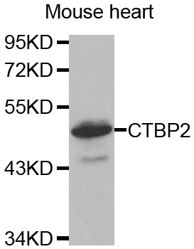 CTBP2 Antibody - Western blot analysis of extracts of Mouse heart cell line, using CTBP2 antibody.