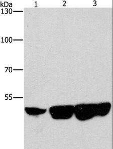 CTBP2 Antibody - Western blot analysis of HeLa, hepG2 and 231 cell, using CTBP2 Polyclonal Antibody at dilution of 1:400.