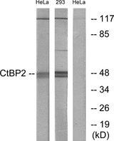 CTBP2 Antibody - Western blot analysis of extracts from HeLa cells and 293 cells, using CtBP2 antibody.