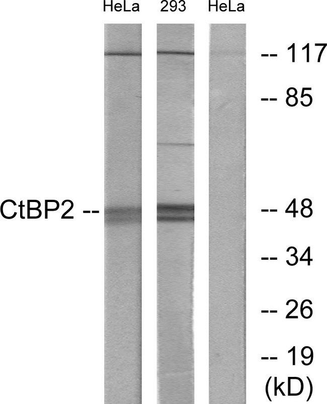 CTBP2 Antibody - Western blot analysis of extracts from HeLa cells and 293 cells, using CtBP2 antibody.