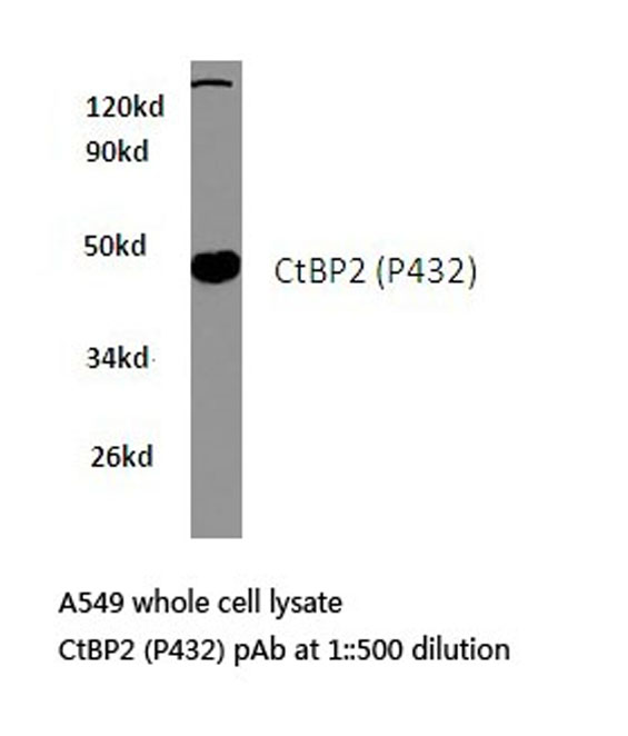 CTBP2 Antibody - Western blot of CtBP2 (P432) pAb in extracts from A549 cells.