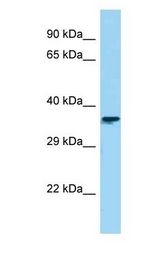 CTBS / CTB Antibody - CTBS / CTB antibody Western Blot of HepG2. Antibody dilution: 1 ug/ml.  This image was taken for the unconjugated form of this product. Other forms have not been tested.