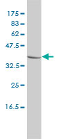 CTBS / CTB Antibody - CTBS monoclonal antibody (M01), clone 1B5-1B9 Western Blot analysis of CTBS expression in MCF-7.