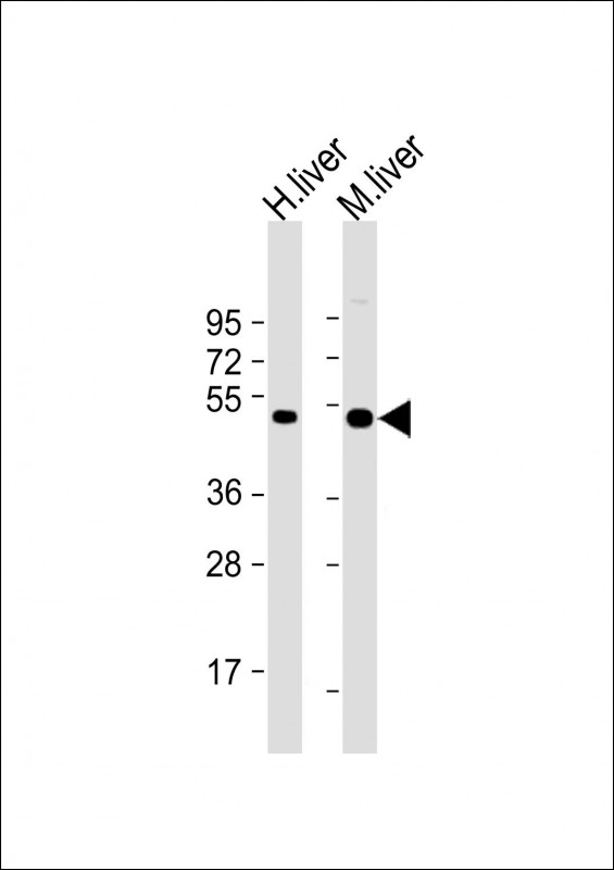 CTBS / CTB Antibody - All lanes: Anti-CTBS Antibody (Center) at 1:2000 dilution Lane 1: human liver lysate Lane 2: mouse liver lysate Lysates/proteins at 20 µg per lane. Secondary Goat Anti-Rabbit IgG, (H+L), Peroxidase conjugated at 1/10000 dilution. Predicted band size: 44 kDa Blocking/Dilution buffer: 5% NFDM/TBST.