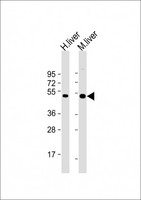 CTBS / CTB Antibody - All lanes: Anti-CTBS Antibody (Center) at 1:2000 dilution Lane 1: human liver lysate Lane 2: mouse liver lysate Lysates/proteins at 20 µg per lane. Secondary Goat Anti-Rabbit IgG, (H+L), Peroxidase conjugated at 1/10000 dilution. Predicted band size: 44 kDa Blocking/Dilution buffer: 5% NFDM/TBST.