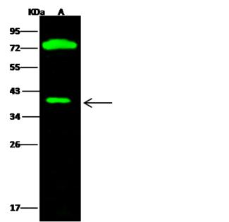 CTBS / CTB Antibody - Anti-CTBS rabbit polyclonal antibody at 1:500 dilution. Lane A: MCF7 Whole Cell Lysate. Lysates/proteins at 30 ug per lane. Secondary: Goat Anti-Rabbit IgG H&L (Dylight 800) at 1/10000 dilution. Developed using the Odyssey technique. Performed under reducing conditions. Predicted band size: 44 kDa. Observed band size: 40 kDa. (We are unsure as to the identity of these extra bands.)
